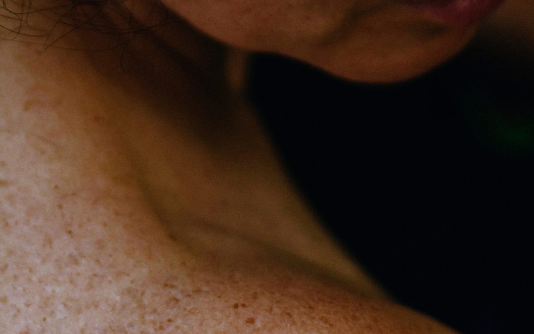 Why Are Shingles Cases Increasing?